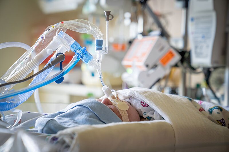 A baby in Neonatal Intensive Care Unit (NICU) with a breathing tube.